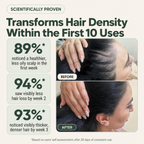 Natural Anti-hair loss Balm