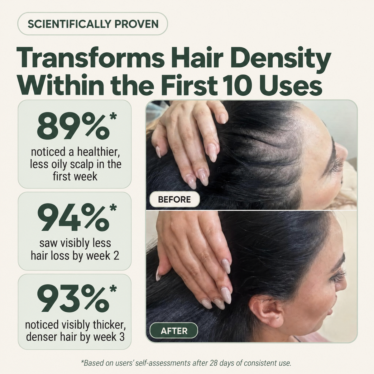 Natural Anti-hair loss Balm