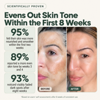 Natural Anti-dark Spot Cream