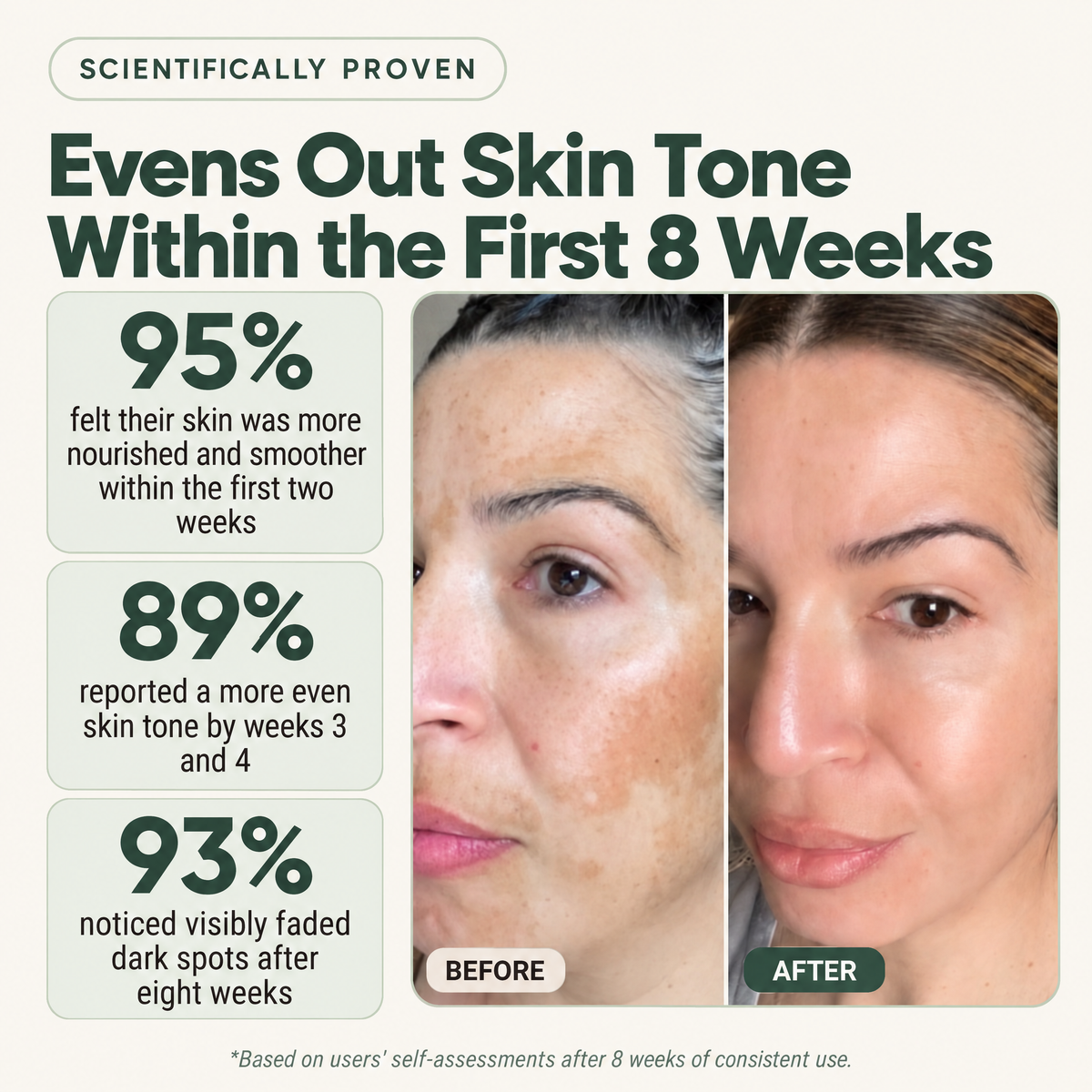 Natural Anti-dark Spot Cream