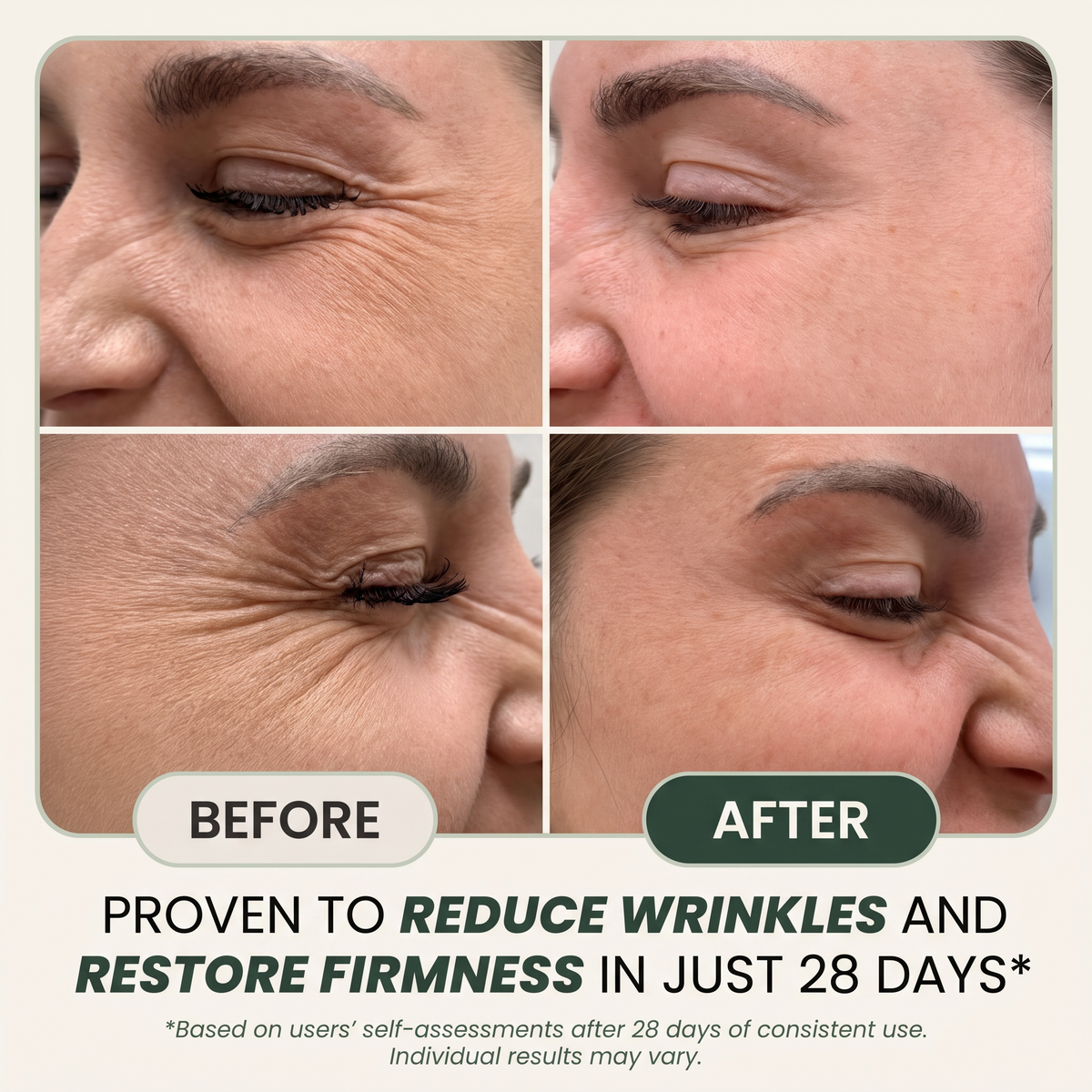 Natural Anti-wrinkle Cream