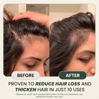 Natural Anti-hair loss Balm