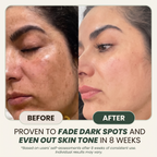 Natural Anti-dark Spot Cream